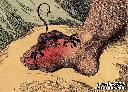 痛风如何快速止痛?特效食疗“两方”,人人家中都有