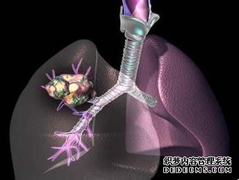 难得一见:中国顶级癌症专家盘点肺癌、乳腺癌、血液肿瘤治疗进展