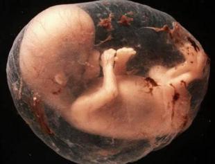 畸形胎、死胎,妈妈孕期只做一件事就可避免!