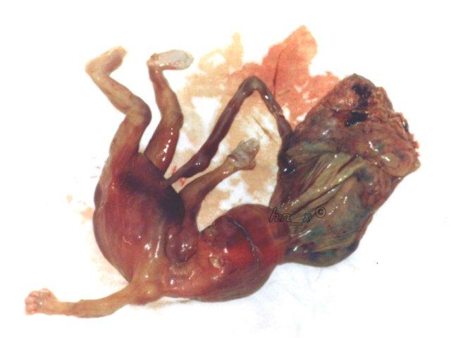 畸形胎、死胎,妈妈孕期只做一件事就可避免!