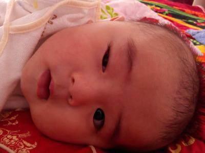 孩子“鸳鸯眼”两只眼睛一单一双,家长应该要警惕