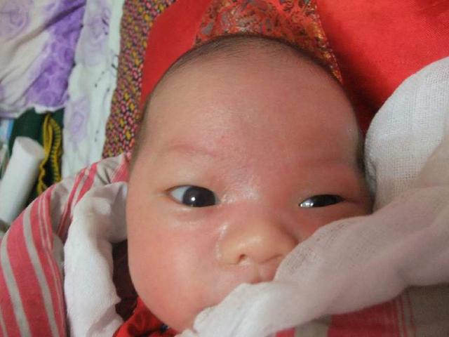 孩子“鸳鸯眼”两只眼睛一单一双,家长应该要警惕