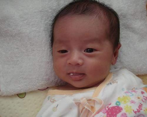 孩子“鸳鸯眼”两只眼睛一单一双,家长应该要警惕