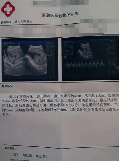 怎么快速看懂孕检报告?一分钟教你轻松掌握!